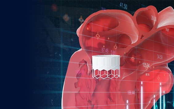 Ilustración de un modelo 3D del corazón con un dispositivo TMVR superpuesto sobre la imagen