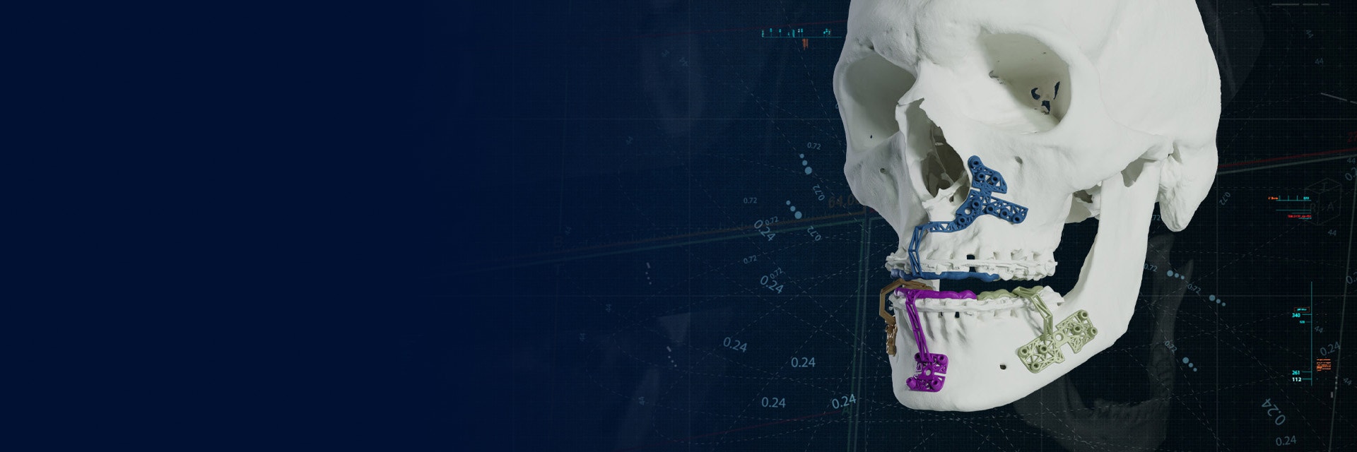 hd-materialise-cmf-solutions-3d-printed-guides-skull-mios.jpg