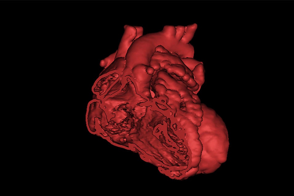 3D image of a cross-section of a heart