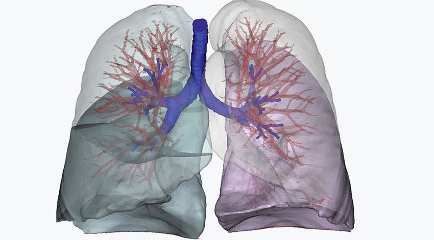 hd-materialise-mimics-3d-model-lungs.jpg