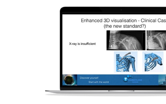 ssm-enhanced-3d-visualisation-clinical-case.jpg
