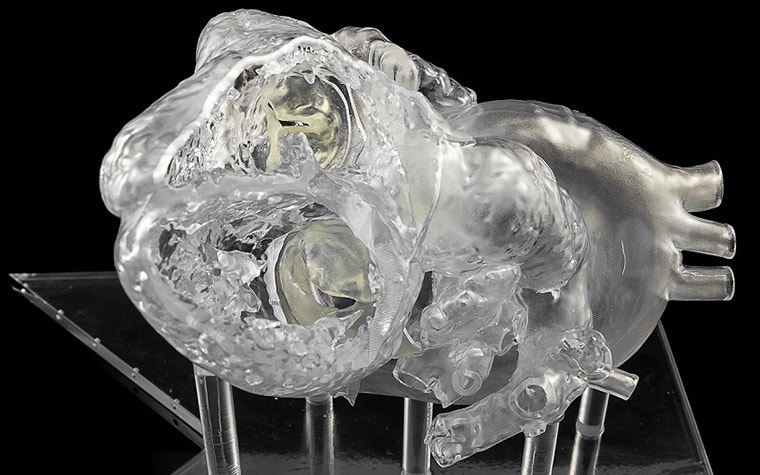 Transparent, 3D-printed heart model on stilt-like structures