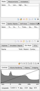 Screenshot from Mimics software