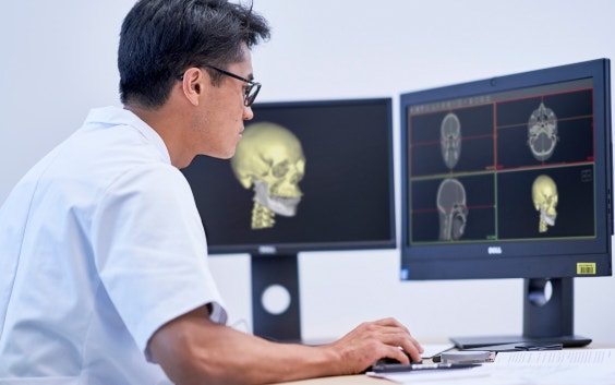 医療ソフトウェアを使って、頭蓋骨スキャン画像を確認する医療専門家
