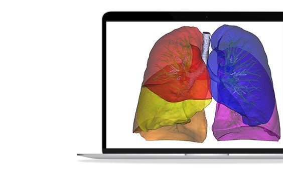 ssm-lung-scan-3d-model-respiratory-imaging.jpg