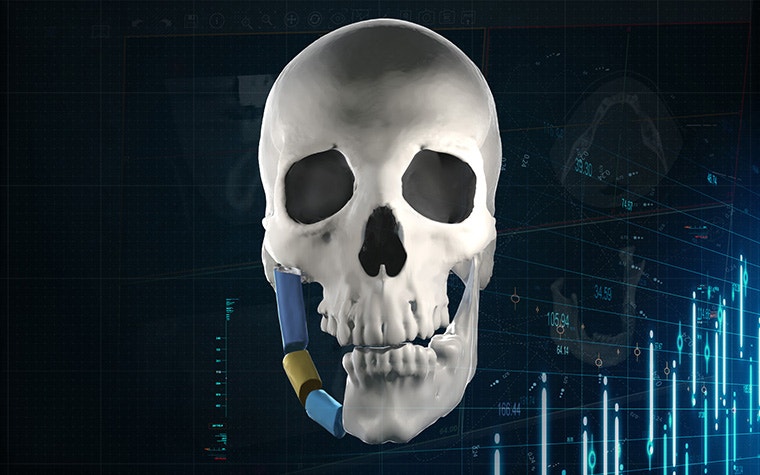 右側の顎を分割した頭蓋骨のデジタル画像