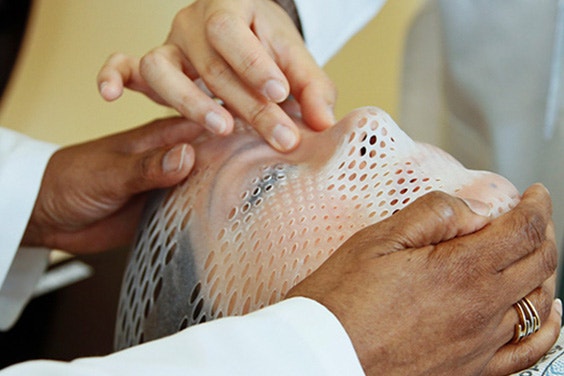 患者の顔面を固定し、治療のための正確な位置決めを行うための標準的な治療器具。