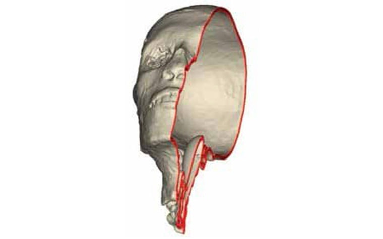 Half of the 3D model of King Tut's skull, hollowed out in 3-matic