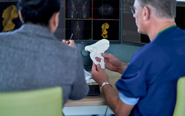Man holding a 3D-printed hip model at a desk next to a woman pointing at 3D planning software on a computer