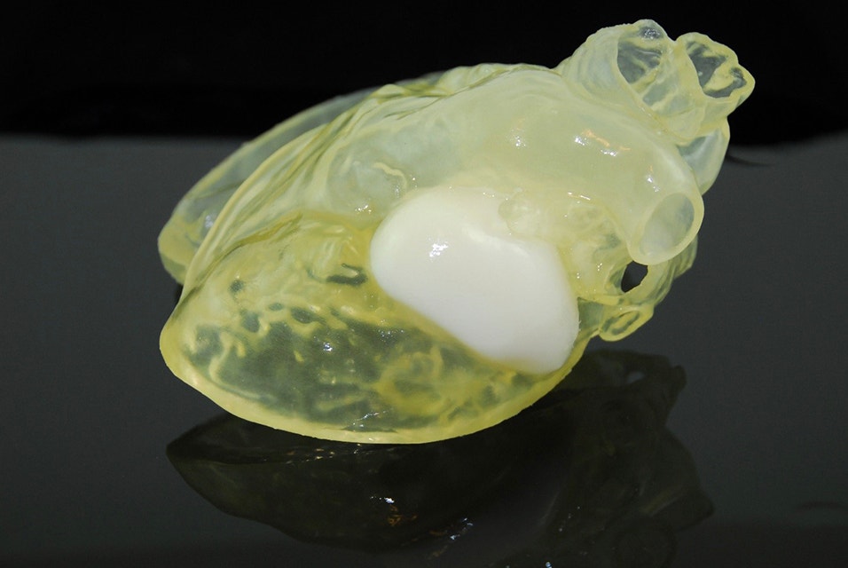 Close-up of Bradley’s 3D-printed heart 