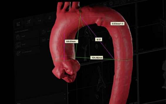 Imagen digital de anatomía con distancias medidas entre varios puntos