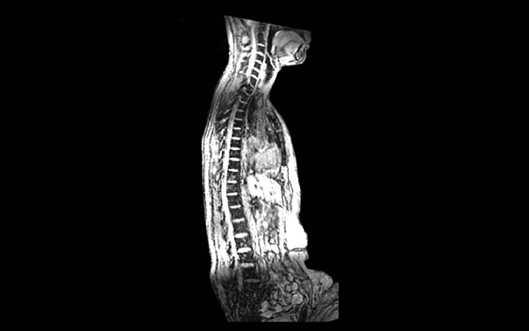 Side view of an anatomy scan of a person's torso