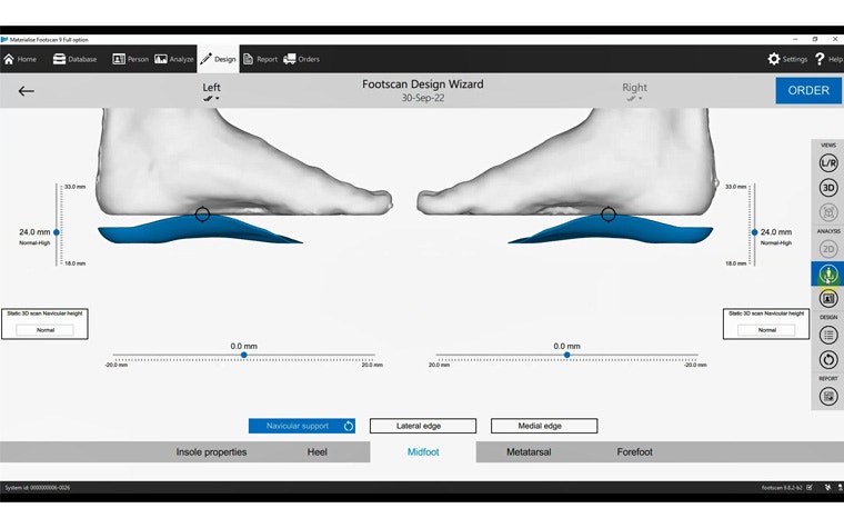 A computer screen featuring the footscan design wizard.