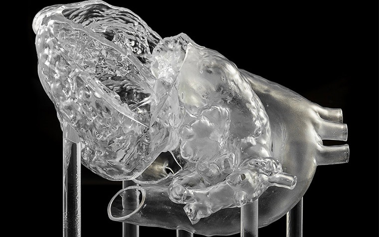 Transparent, 3D-printed heart model on stilt-like structures