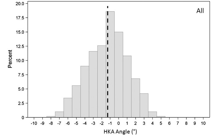 Bar chart showing cross-sectional study of 250 people with variations in natural knee alignment 