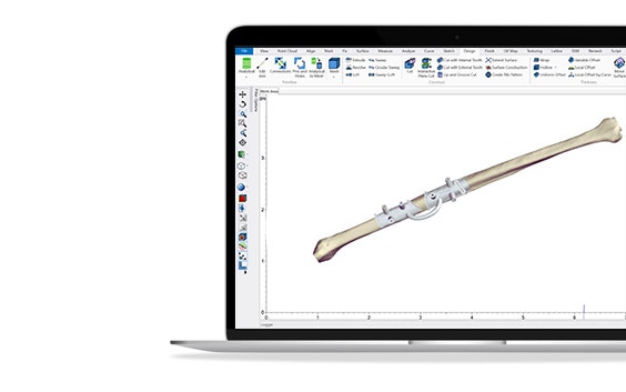 Mimics Innovation Suite software showing on a computer screen with a 3D model of a bone and a personalized surgical guide