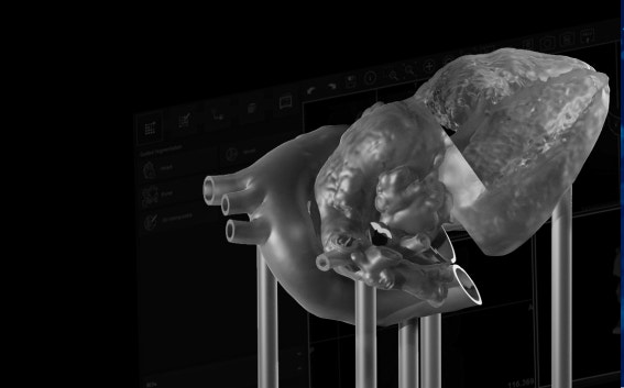 Modelo impreso en 3D transparente de un corazón en postes
