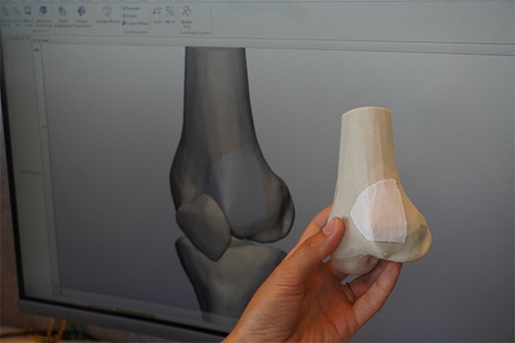 Hand holding a bone model with a 3D-printed component in front of a computer screen showing the model in software