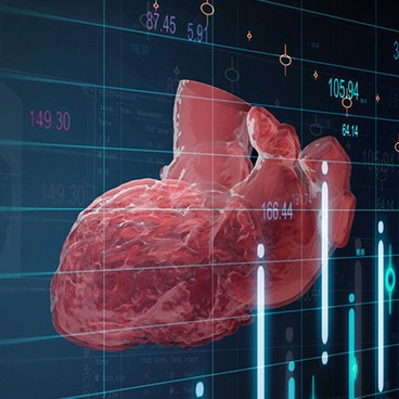 FEops社の心臓構造計画を加速させた自動化とは