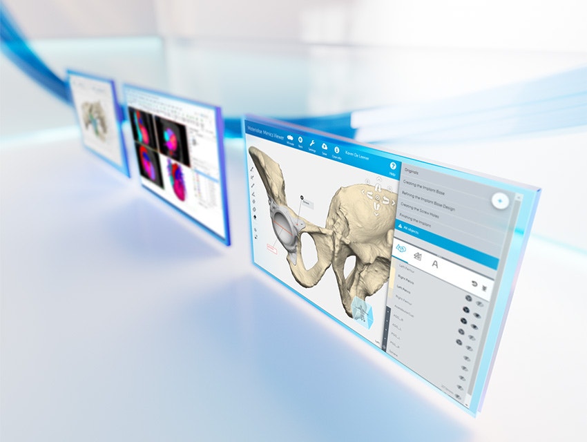 Trois écrans montrant l'anatomie du patient dans le logiciel de la plateforme Materialise Mimics sur un fond blanc réfléchissant avec des lignes bleues.