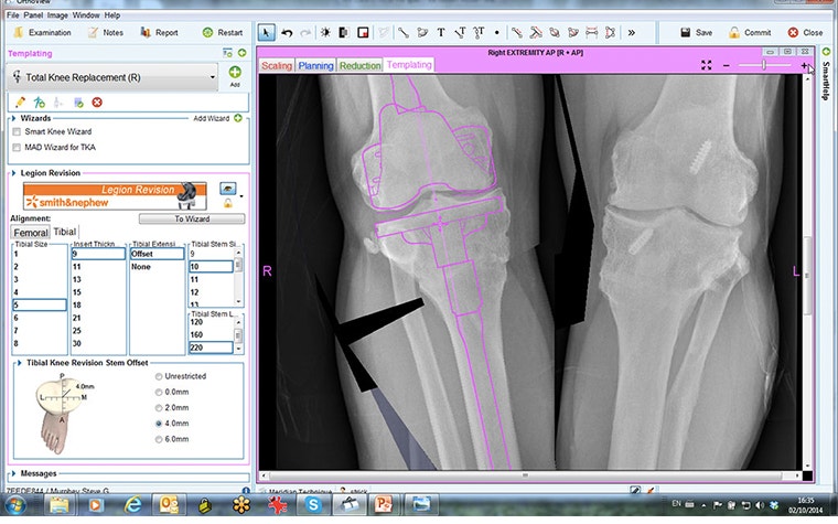 OrthoView showing X-ray of knees