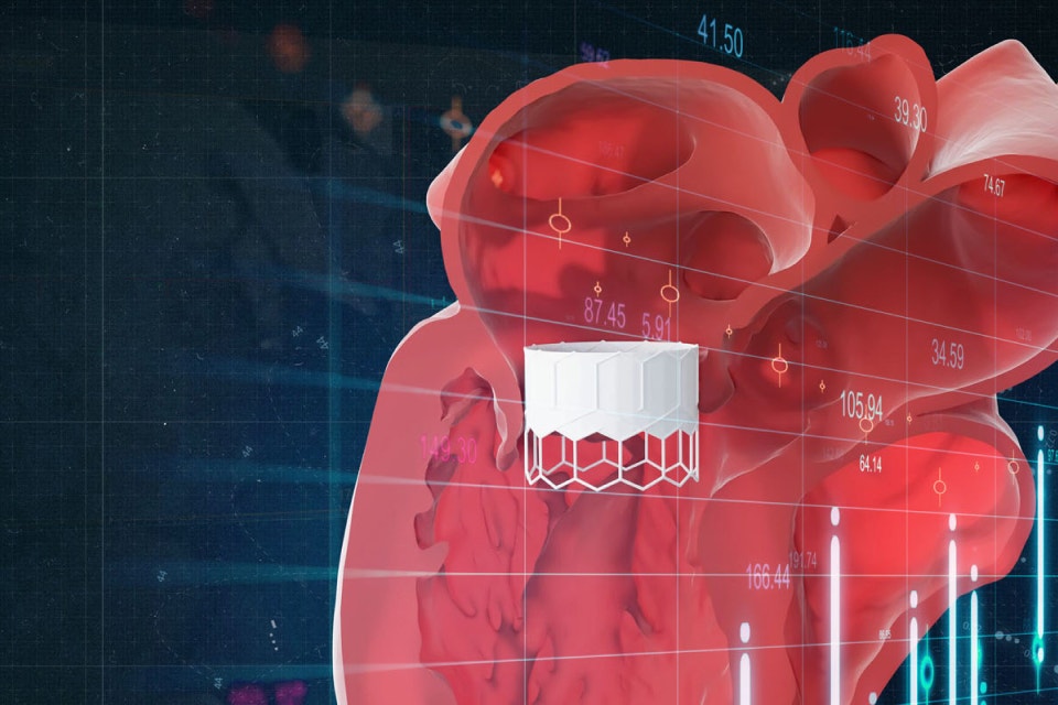 Darstellung eines 3D-Modells des Herzens mit einem TMVR-Gerät, das auf das Bild eingeblendet wird