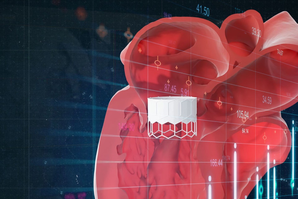 Illustration of a 3D model of the heart, with a tmvr device superimposed on the image 