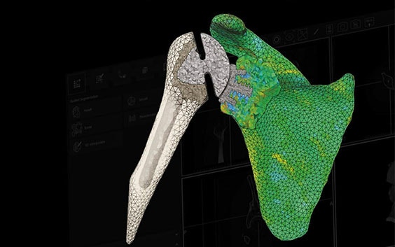 Digital image of anatomy in STL