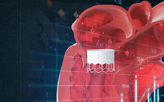 Ilustración de un modelo 3D del corazón con un dispositivo TMVR superpuesto sobre la imagen