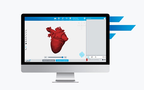 Computer screening showing Mimics Flow Case Management software with a heart model