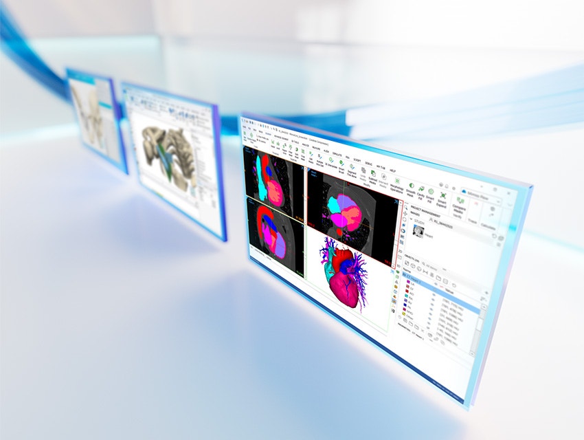 Trois écrans montrant l'anatomie du patient dans le logiciel de la plateforme Materialise Mimics sur un fond blanc réfléchissant avec des lignes bleues.