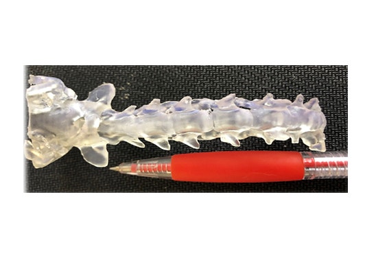 3D-printed model of the cervical spine and caudal part of the skull of a toy breed dog with atlanto-axial subluxation showing the size comparision in relation to a pen. 