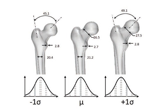Examples of calculations on femurs 