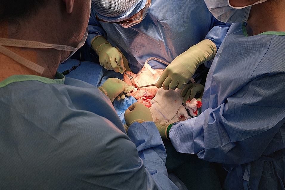 Surgeons conducting a condylectomy on a patient