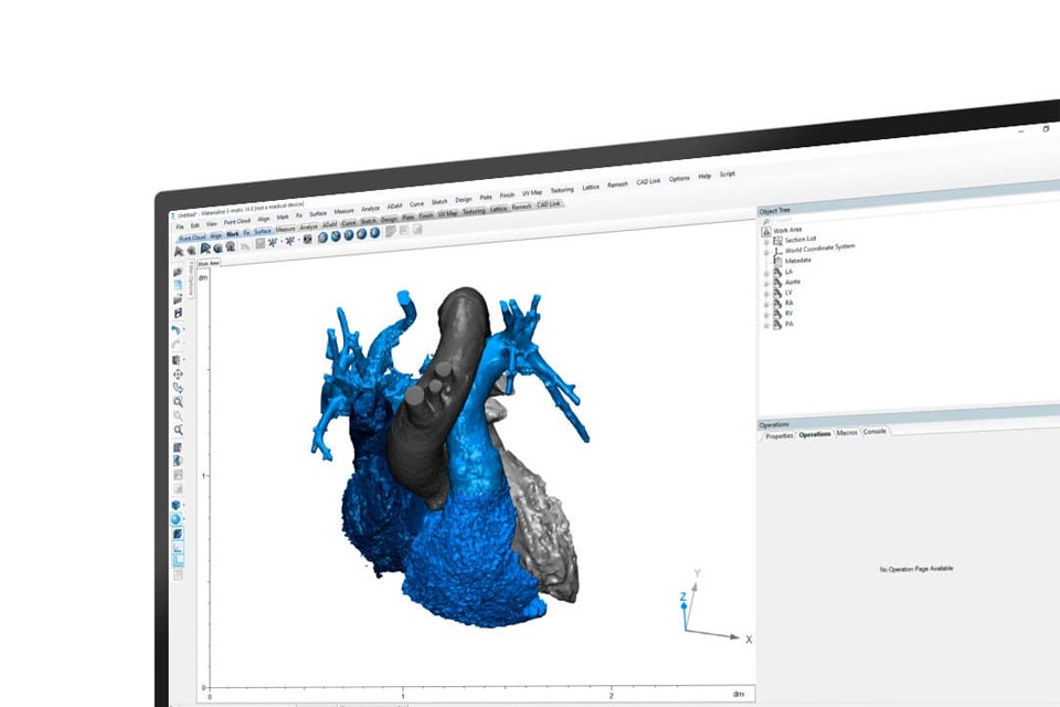 Écran d'ordinateur montrant l'anatomie du cœur sur le logiciel 3-matic