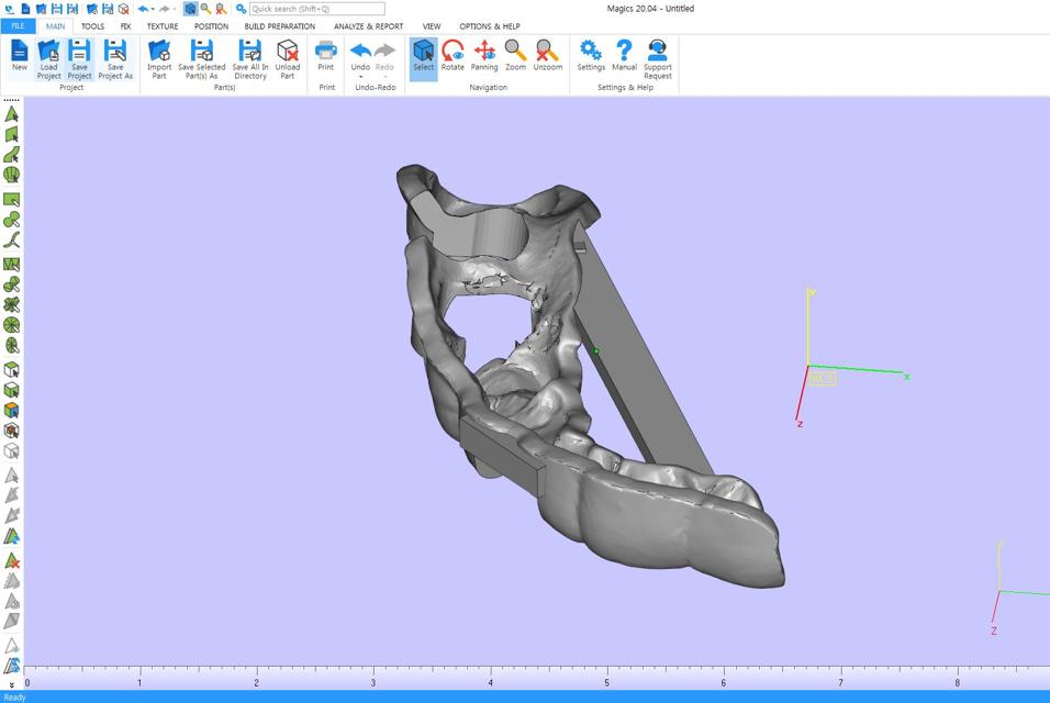 3D model of a dental implant in Magics