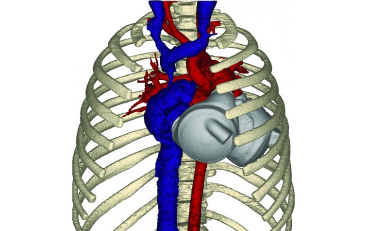 Digital image of a skeleton torso