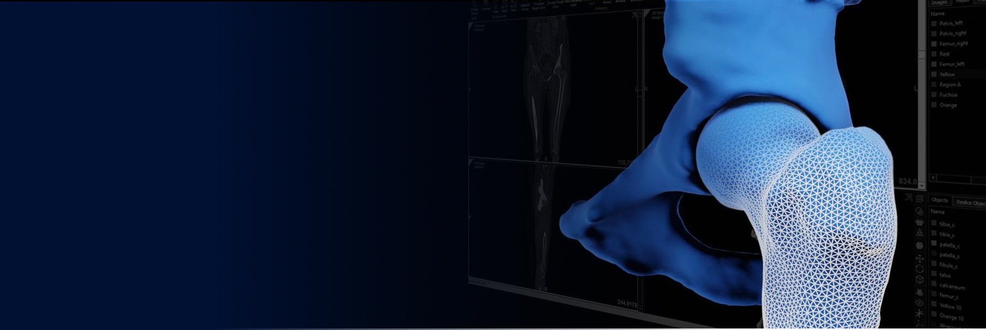 Digitales Bild eines Knochens mit Markierungen auf dem unteren Vorderteil