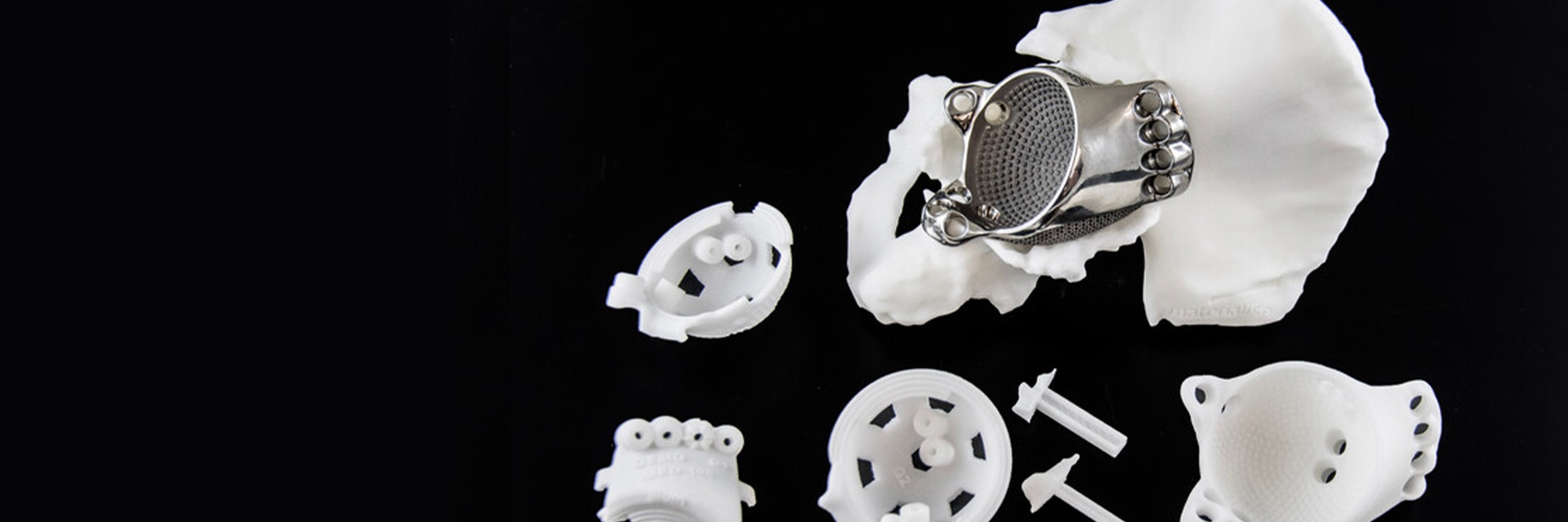 3D-printed implant in a hip model next to 3D-printed surgical guides