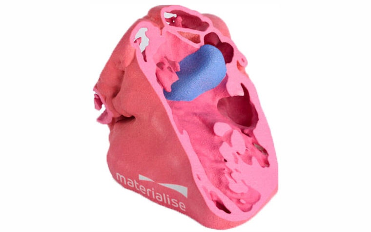 Cross-section of a 3D-printed anatomical model with the Materialise logo