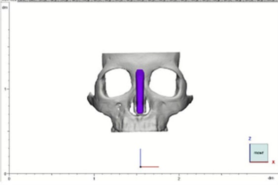 Skull anatomy in medical software