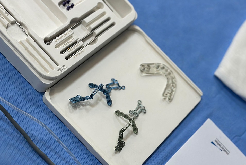 Custom surgical implants and instruments arranged in a sterilization tray on a surgical table, including fixation plates.