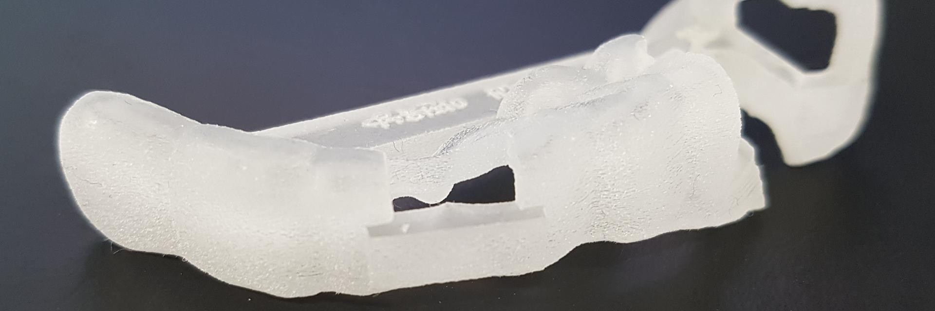 3D-printed dental implant