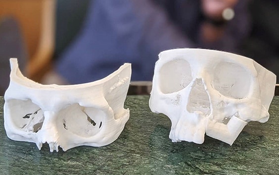 3D-printed skulls on a table