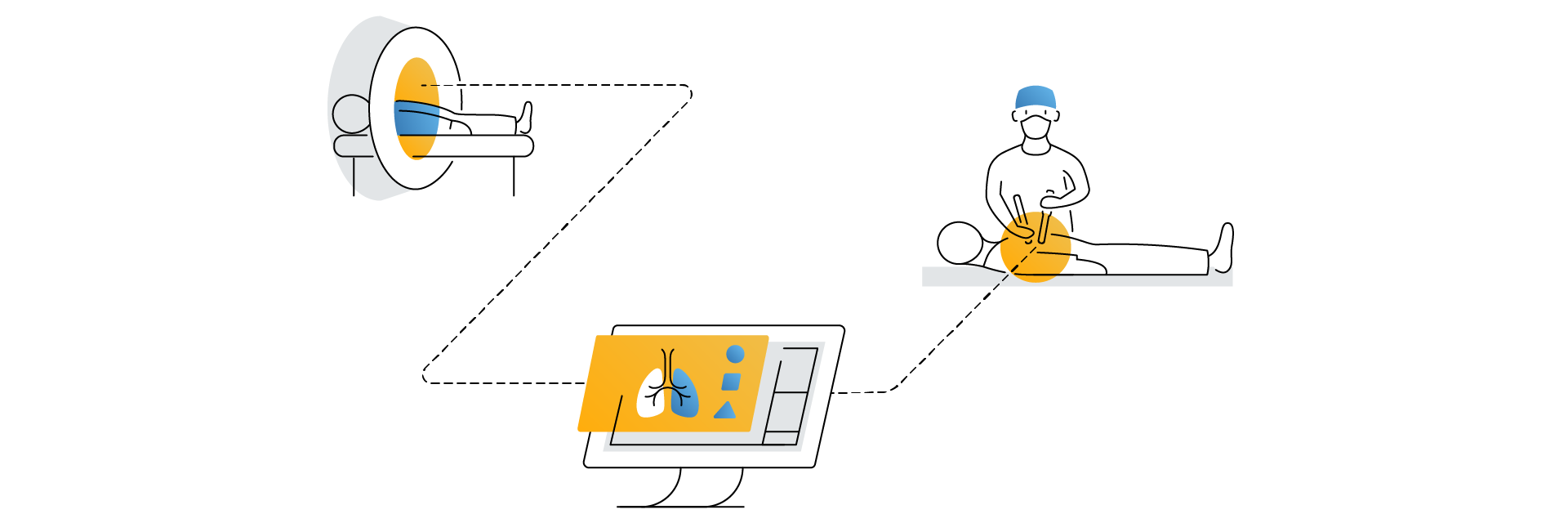 Cartoon graphic showing the full workflow, from patient scan to 3D planning to surgery