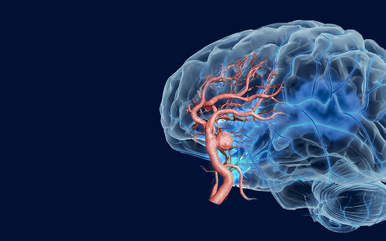 A semi-transparent 3D rendering of a human brain with highlighted blood vessels on a dark blue background.