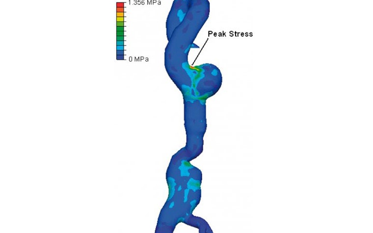 Virtual image of anatomy a stress map applied