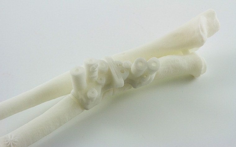3D-printed surgical guide