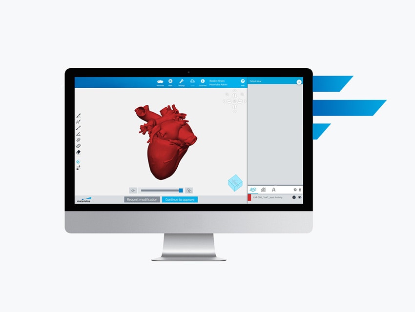 Computer screening showing Mimics Flow Case Management software with a heart model