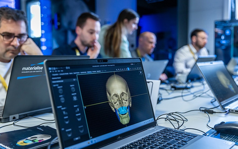 Laptop showing a 3D digital skull model with a segmented jaw region, surrounded by several blurred individuals working at computers in a training room.